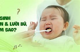 Bé 3 Tháng Tuổi Lười Bú Phải Làm Sao